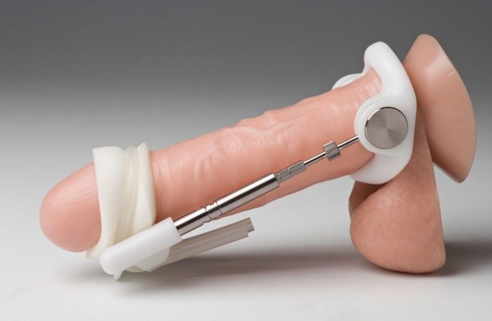 Extend to increase the thickness of the penis